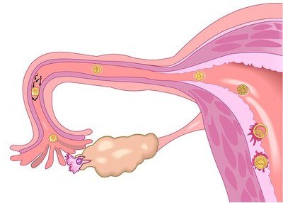 留意&&有5种病症，你双侧输卵管很有可能堵住了！